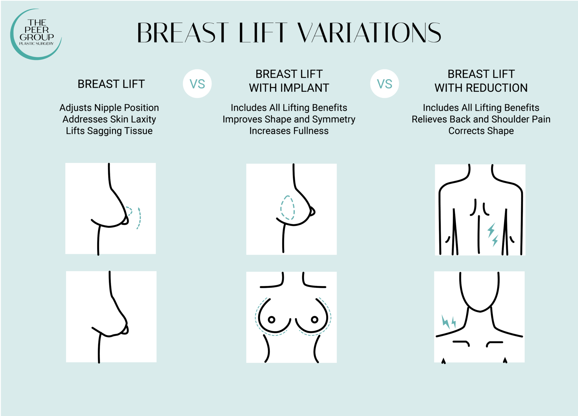 Explore three variations of breast lift at New Jersey’s The Peer Group.