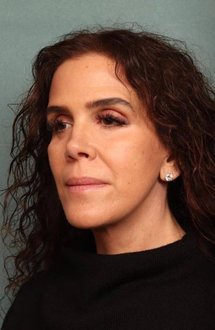 Facelift Before & After Patient #9158